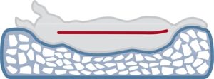 Trixie Vital Hondenmand Bendson Orthopedisch Grijs - Afbeelding 8